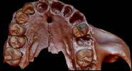Fóssil contendo o dente analisado pelos pesquisadores - Divulgação / Copenhagen University